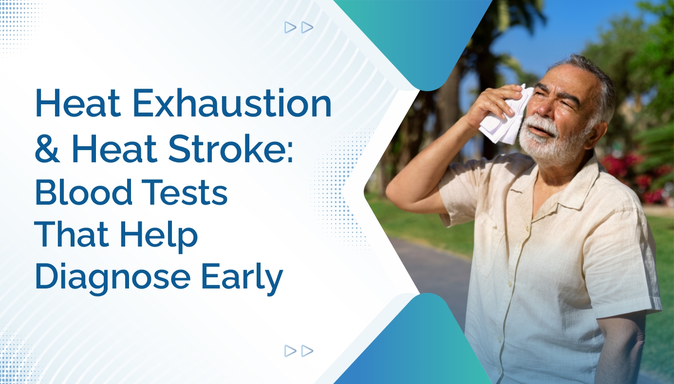 Heat Exhaustion and Heat Stroke- Blood Tests That Help Diagnose Early